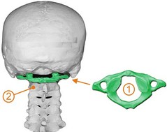 Los Angeles Chiropractor--atlas subluxation, neck pain